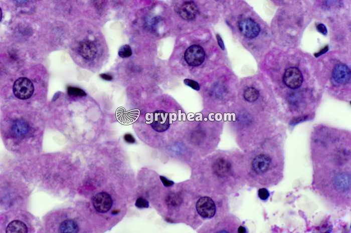 Glycogène dans du Foie x400 - gryphea.org